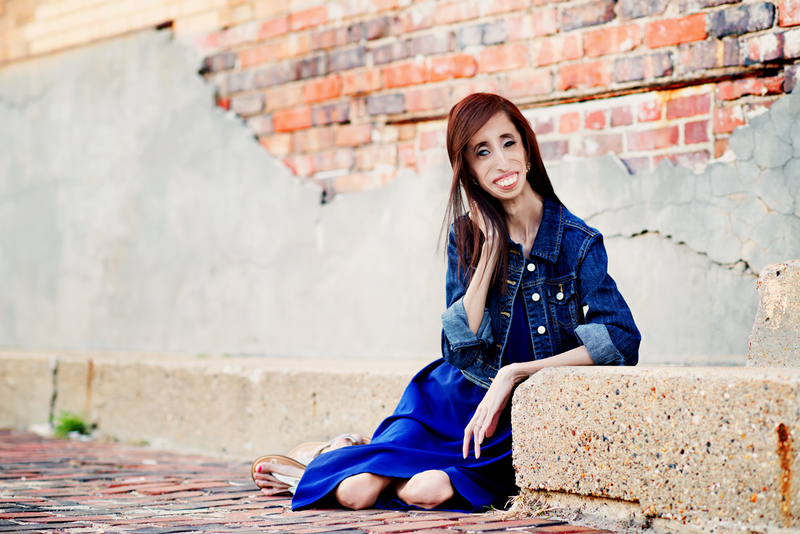 Lizzie Velasques: Eu Sou a Mulher Mais Feia do Mundo?